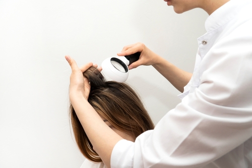 Diagnosing Postpartum Hair Loss