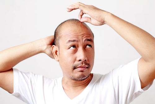Secrets of Hair Transplants How They Promote Regrowth